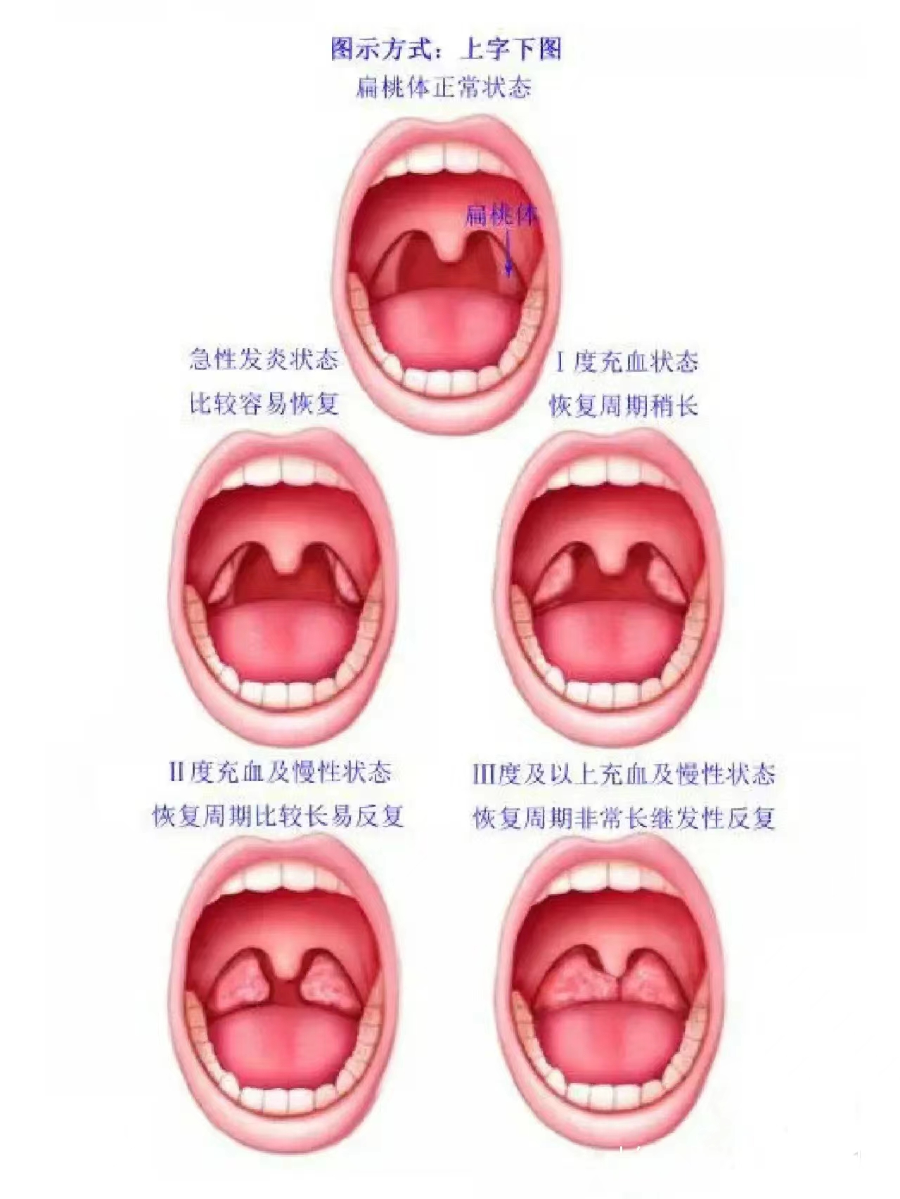 嗓子眼位置图图片