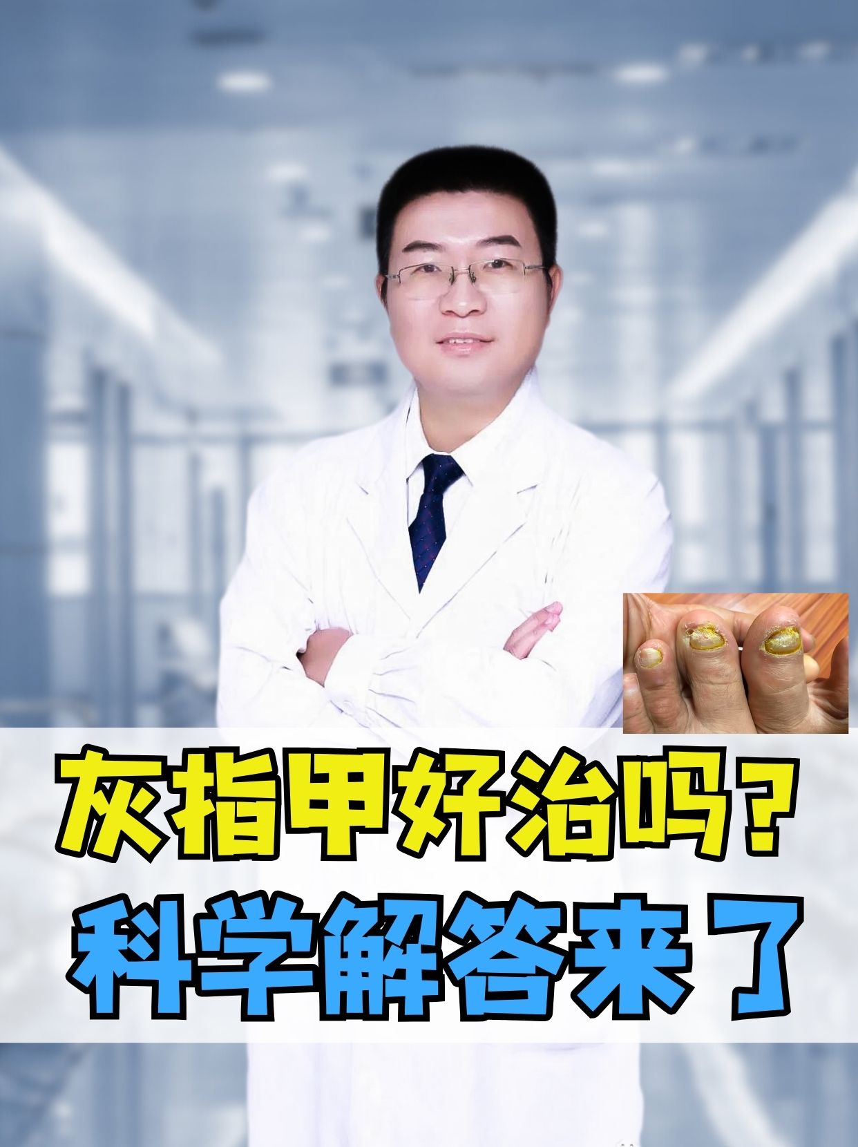 科学解答来了  灰指甲,医学上称为甲癣,是由真菌感染引起的指甲疾病.