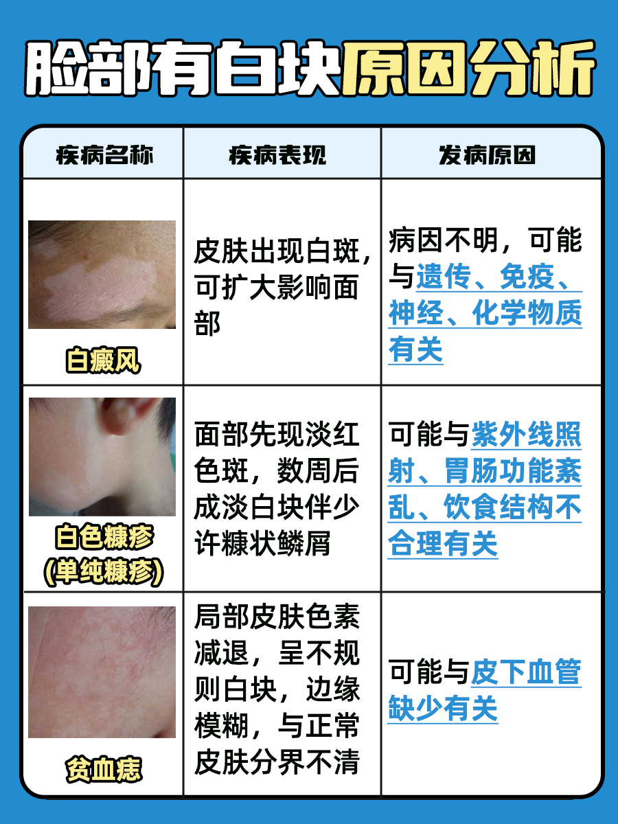 的原因  不经意间照镜子时,突然发现脸上出现了白块,究竟是怎么回事?