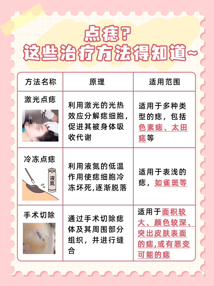 药水点痣真的能点干净吗?