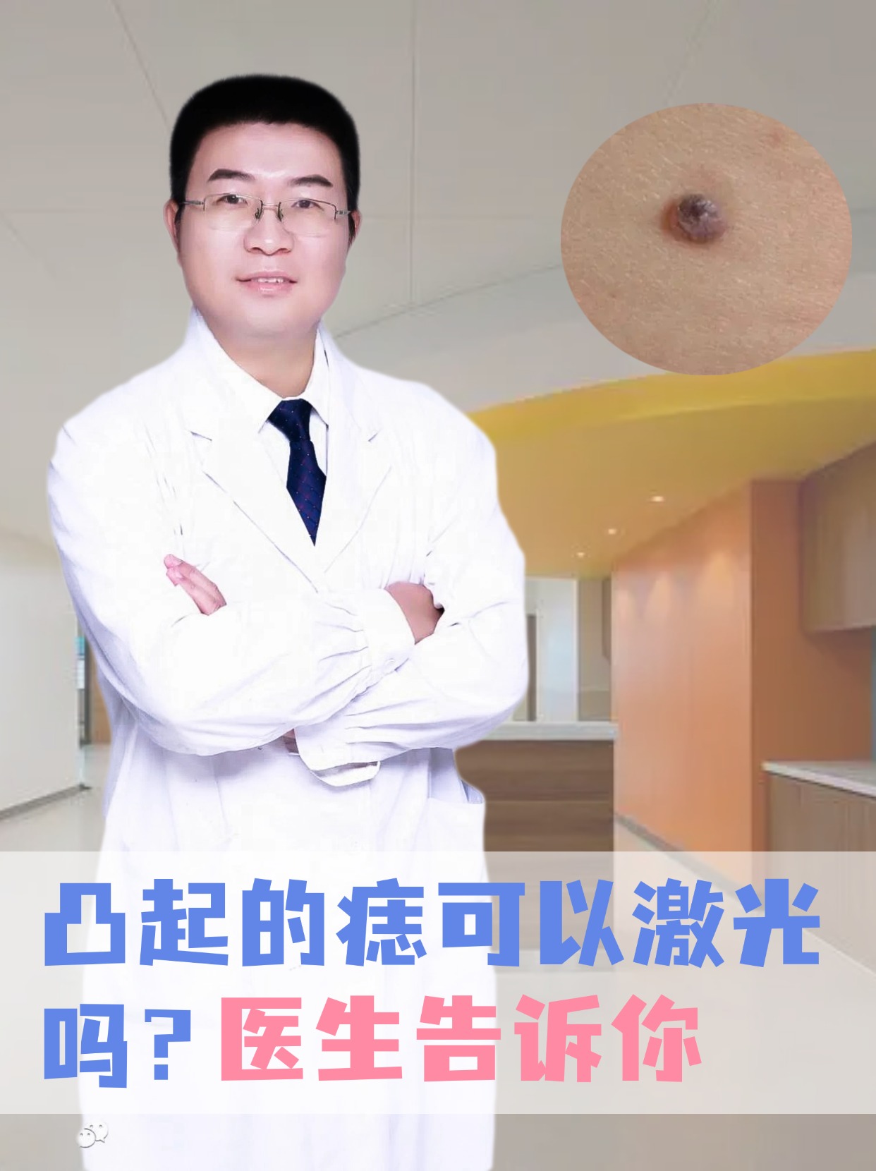 医生告诉你  在生活中,常常会在身上看到一些凸起的痣,不少人会考虑