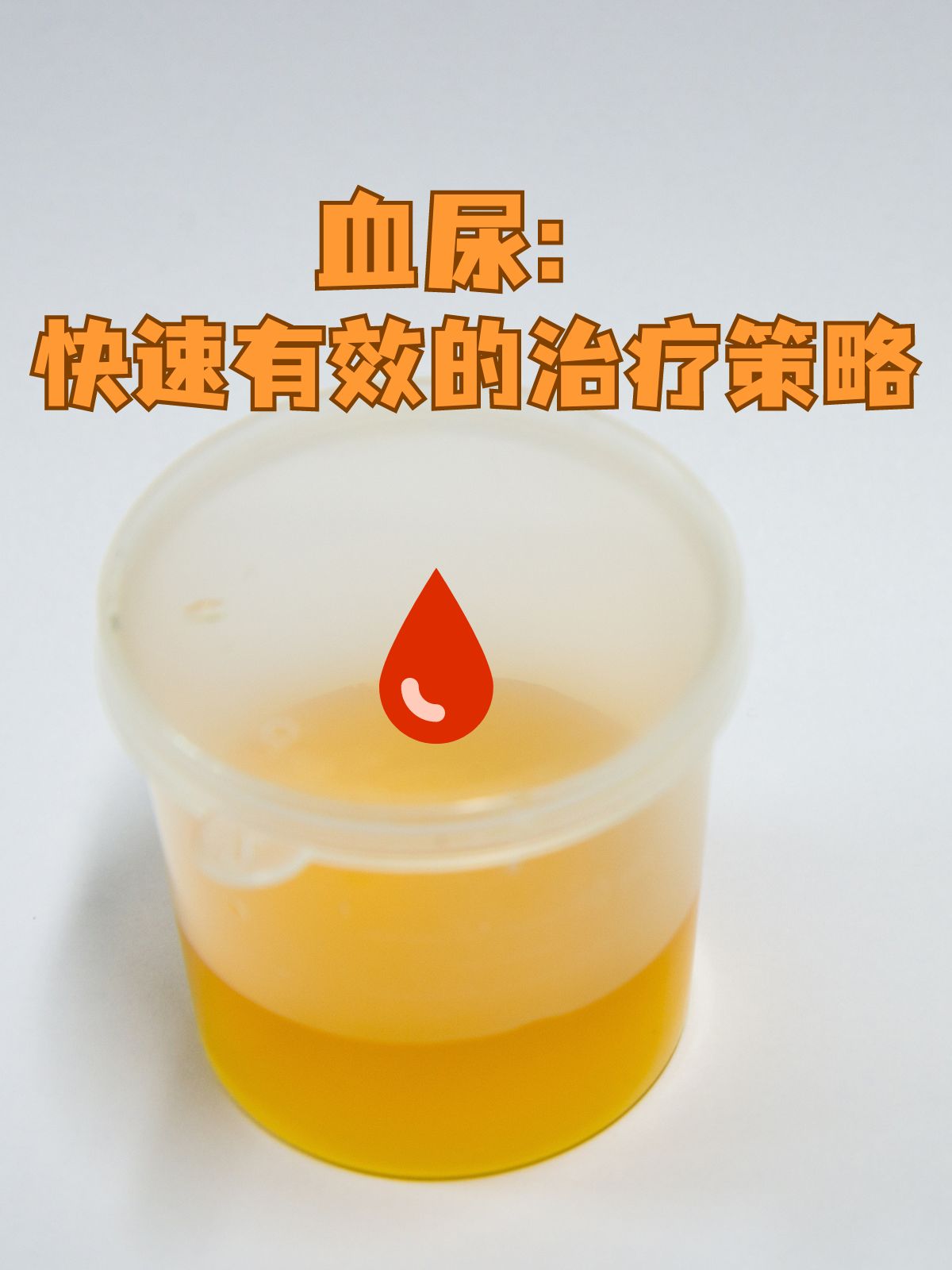 血尿:快速有效的治疗策略#笔记里的健康知识#