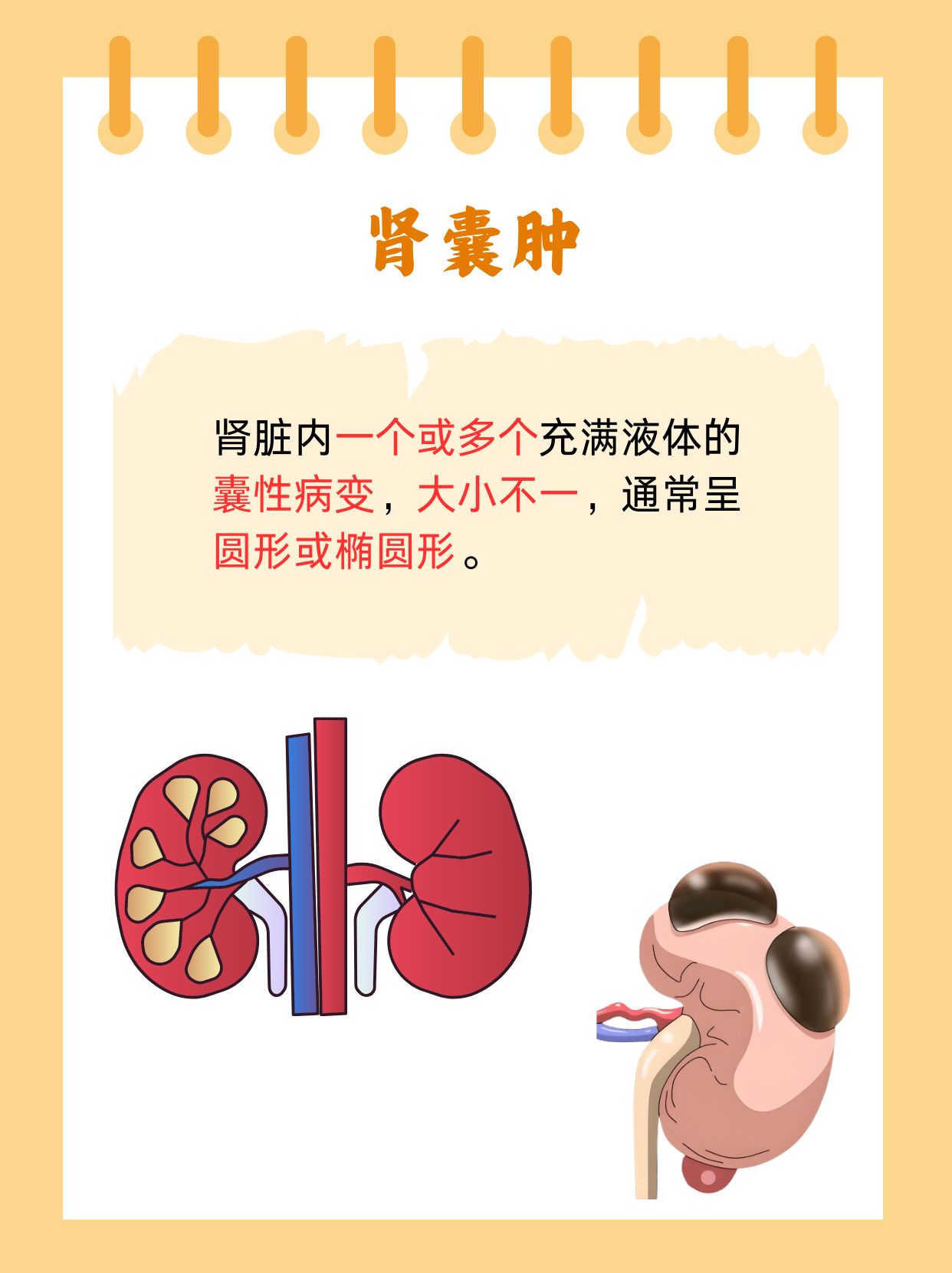 女性为什么会左肾囊肿