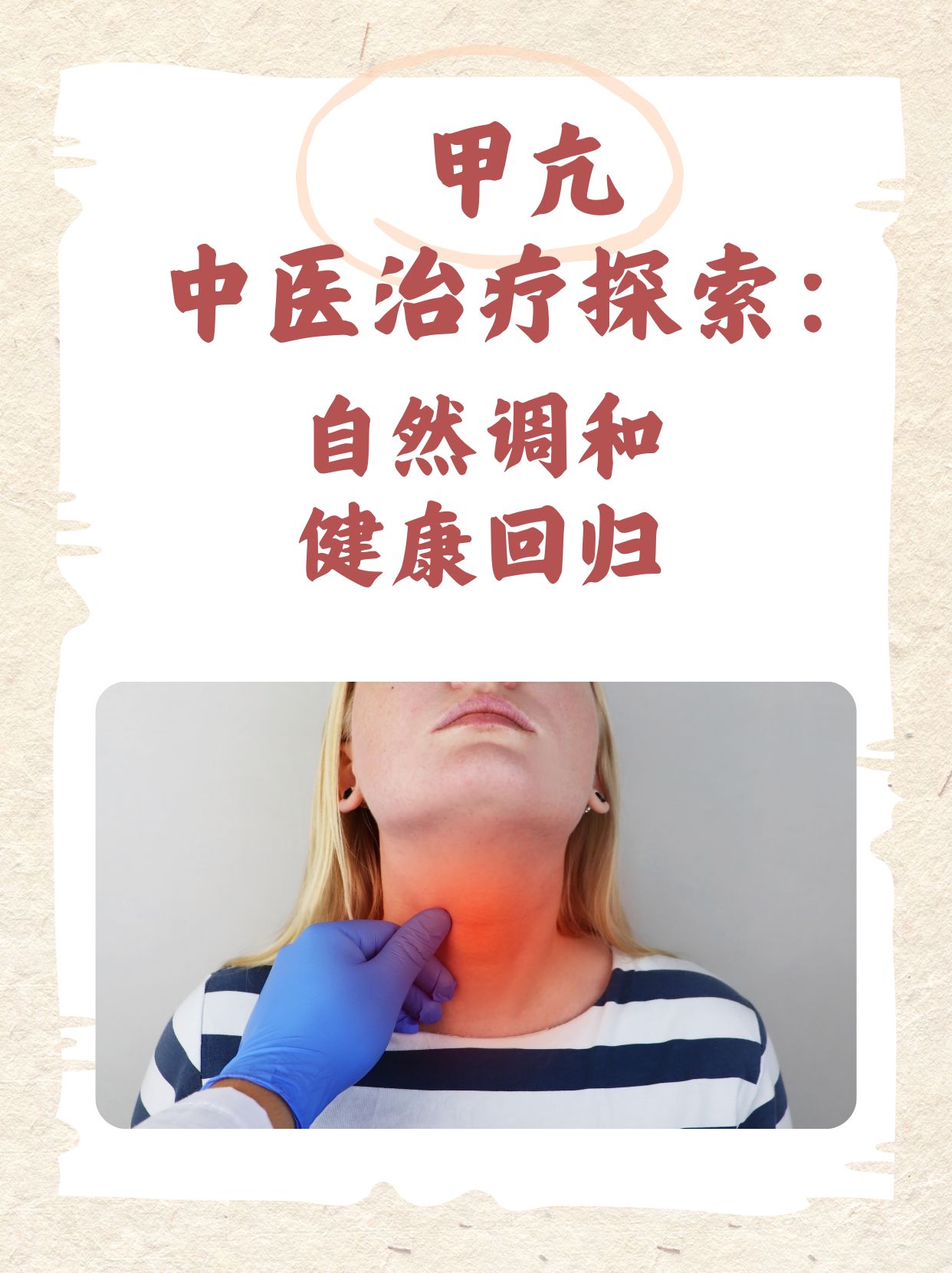 其实祖国医学在治疗甲亢方面也有其独到的见解西医治疗效果较差或者