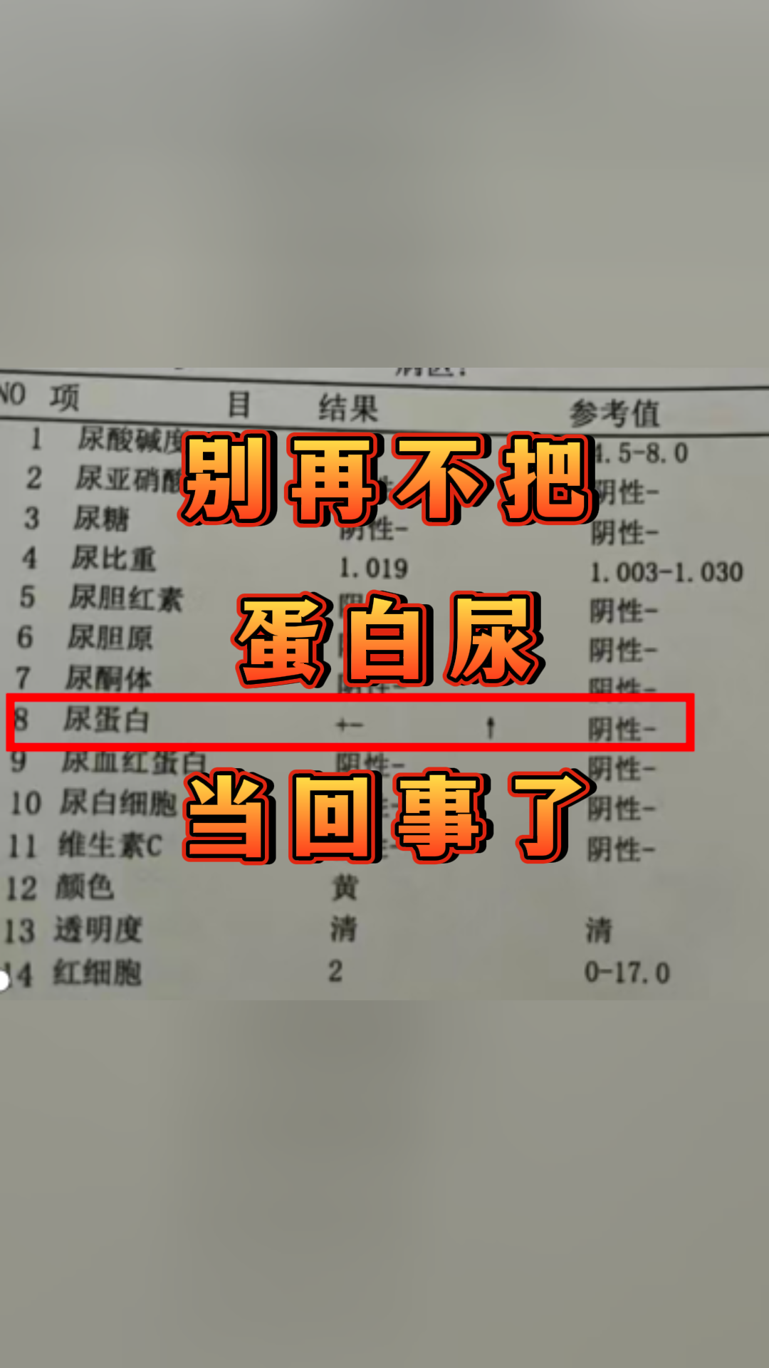 别再不把,蛋白尿,当回事了