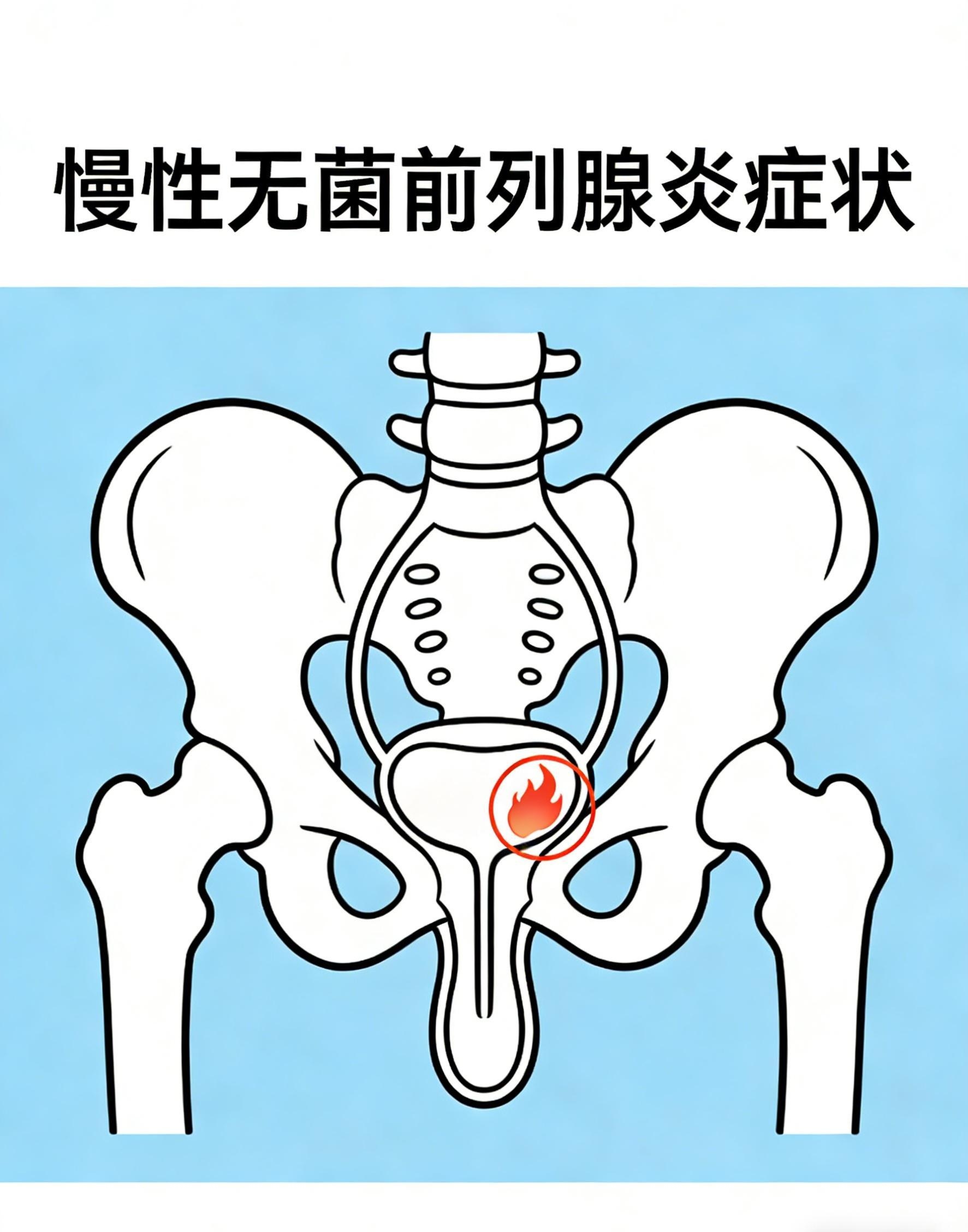 慢性无菌前列腺炎症状 慢性无菌前列腺炎的症状多样以排尿异常疼痛