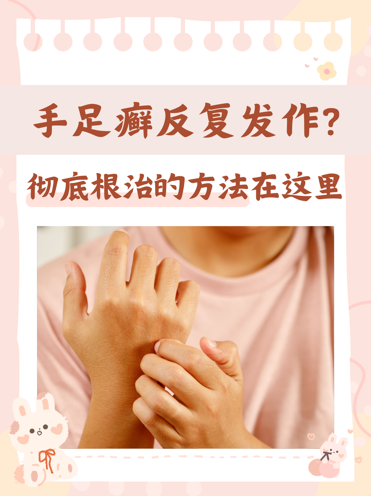 手足癣是一种常见的真菌感染性皮肤病,主要