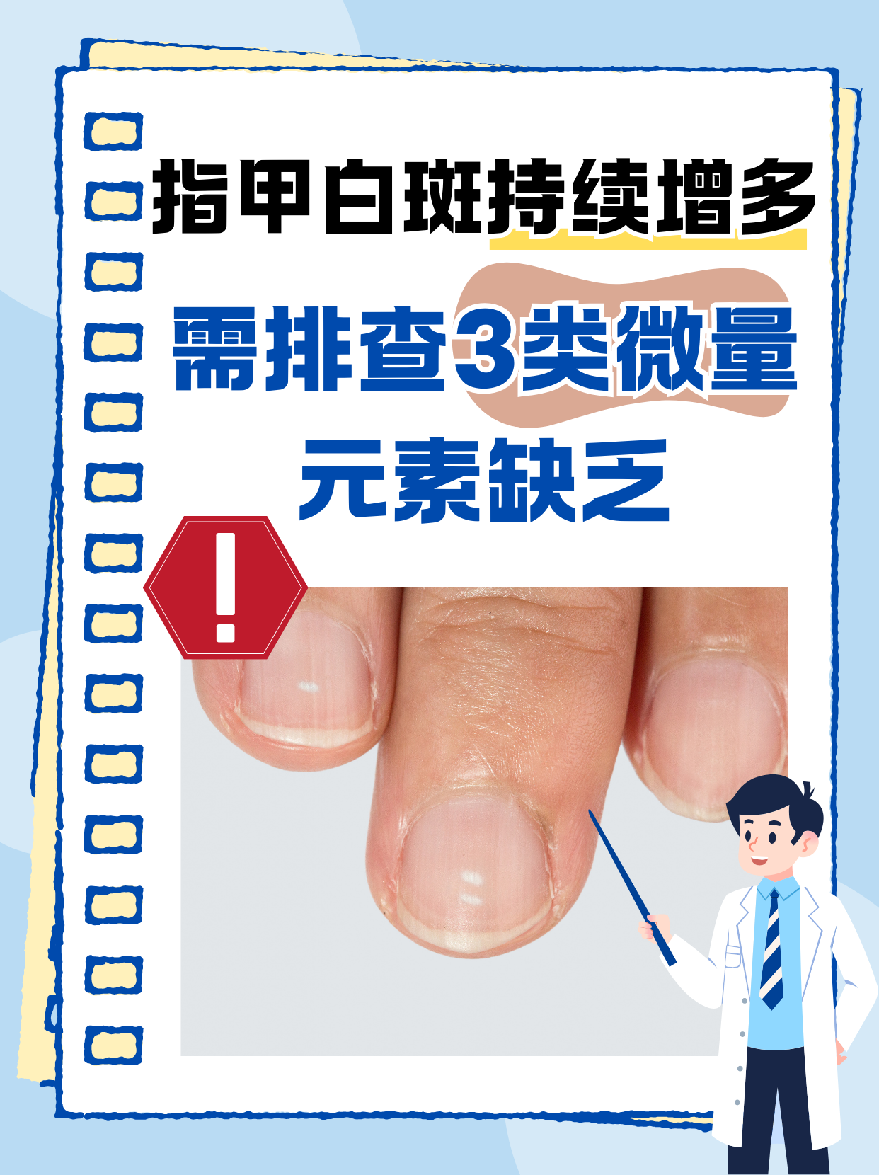 指甲白斑,医学上称为"点状白甲"或"部分白