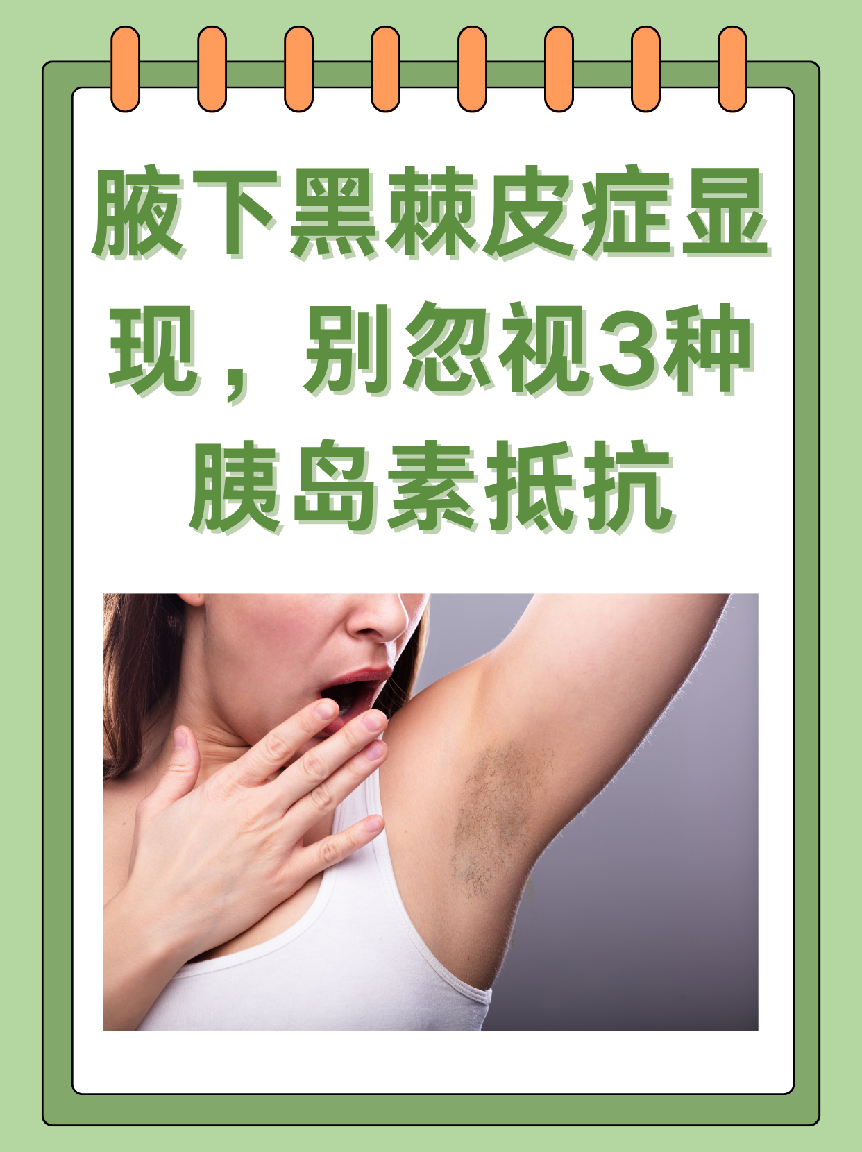 腋下黑棘皮症显现,别忽视3种胰岛素抵抗