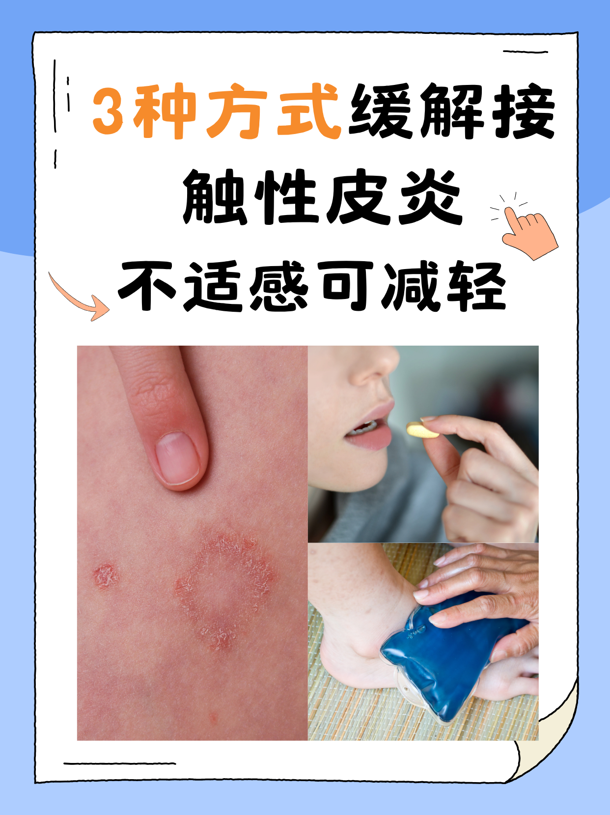 这种疾病会导致皮肤红肿,瘙痒,疼痛甚至起水泡,给病患带来极大的不适