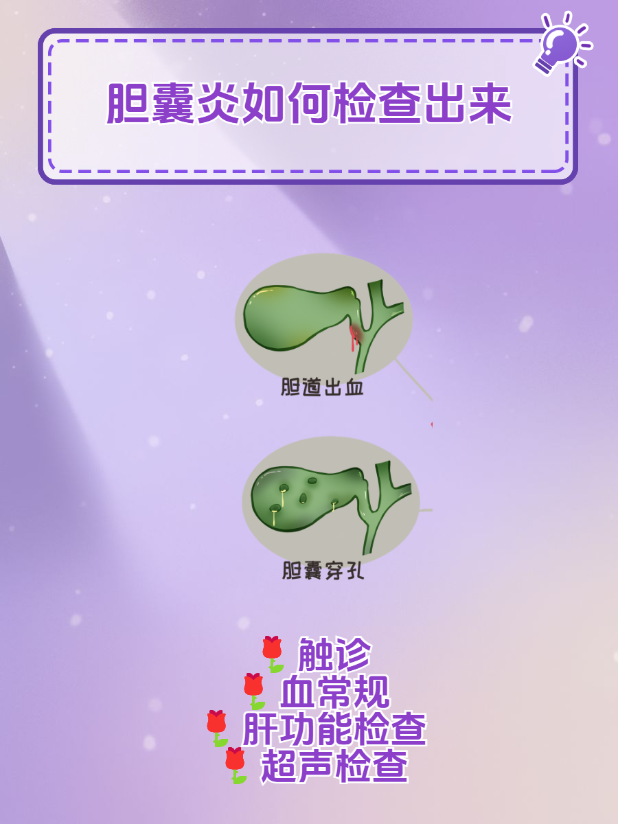 胆囊炎如何检查出来?