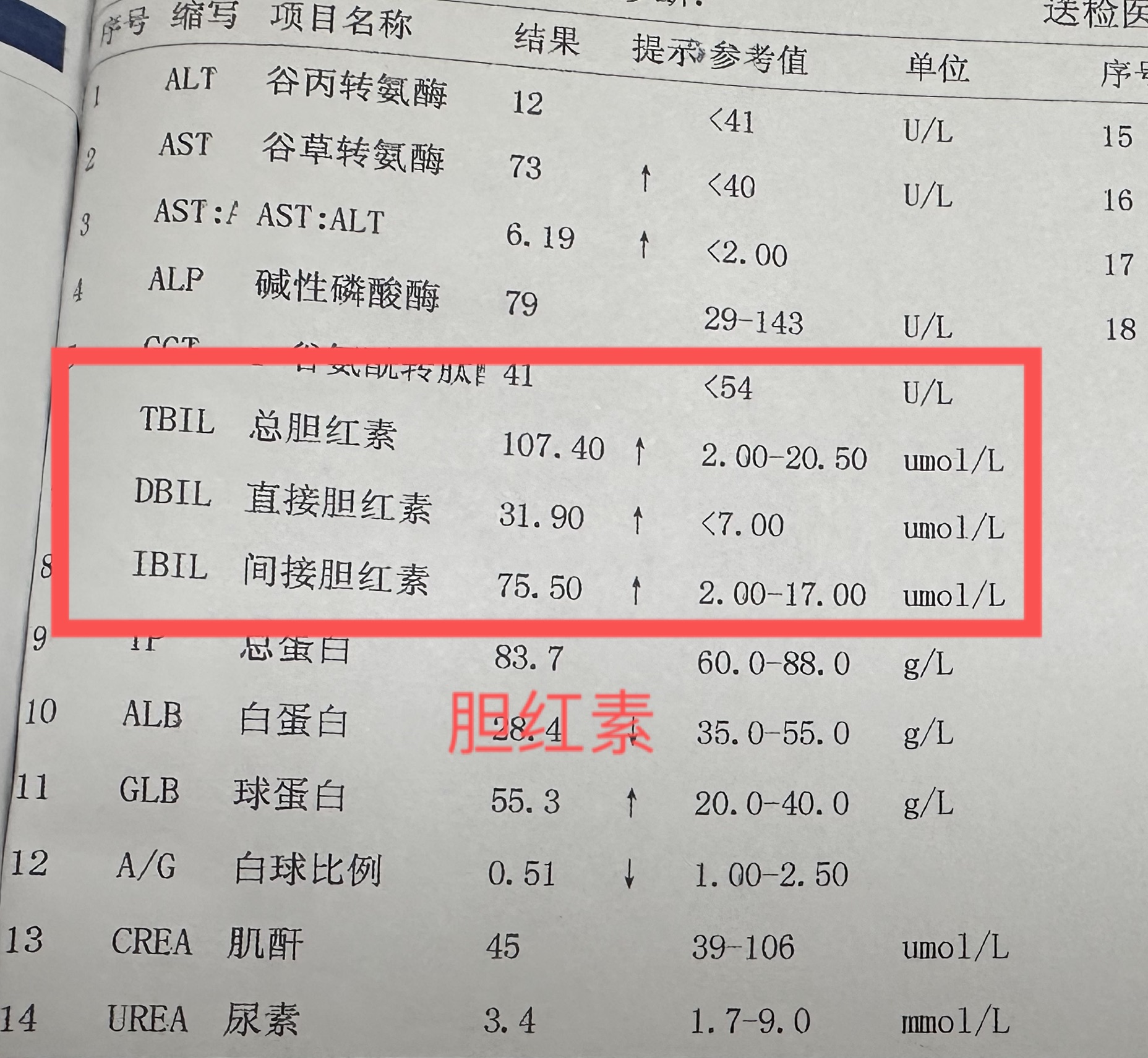 —胆红素 肝功能检查单中的胆红素指标是评估