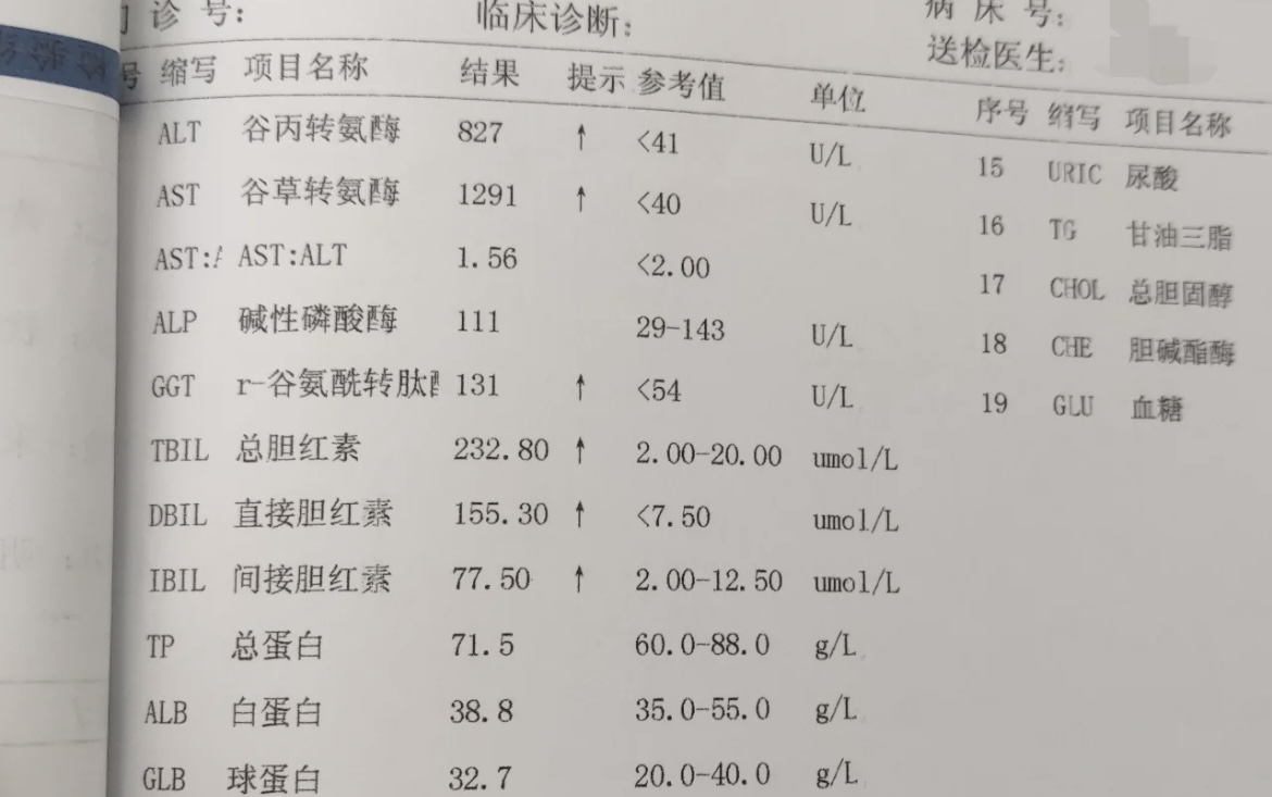 或发生病变,其水平就会显著升高,成为医生诊断肝脏疾病的重要依据之一