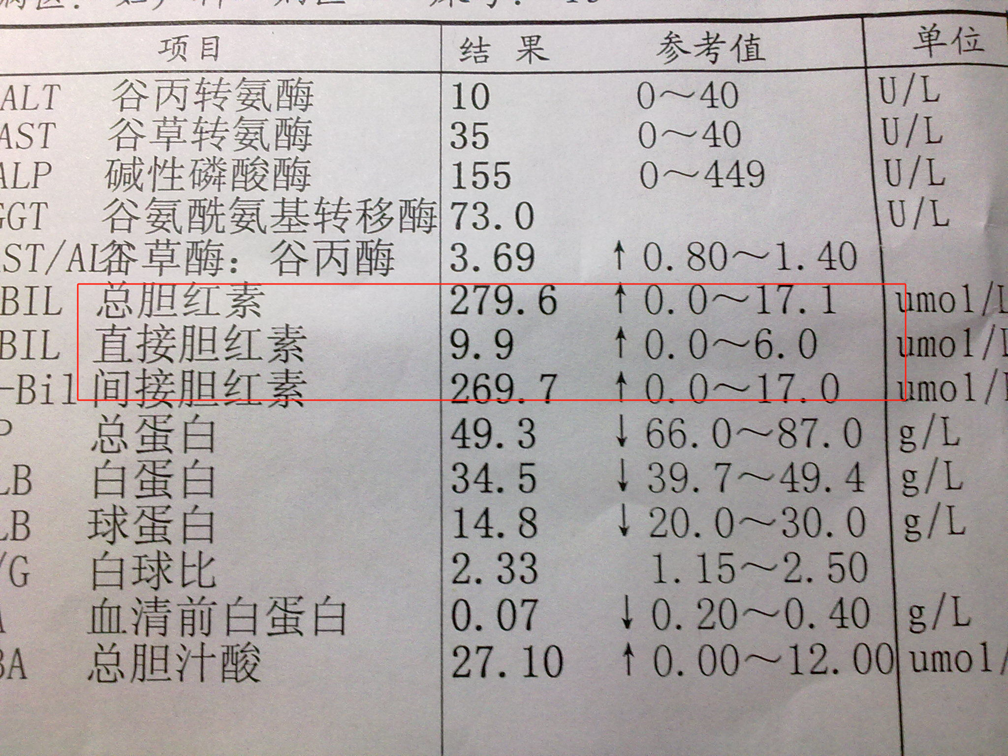—胆红素 在体检报告中,看到胆红素数值时,可以分开