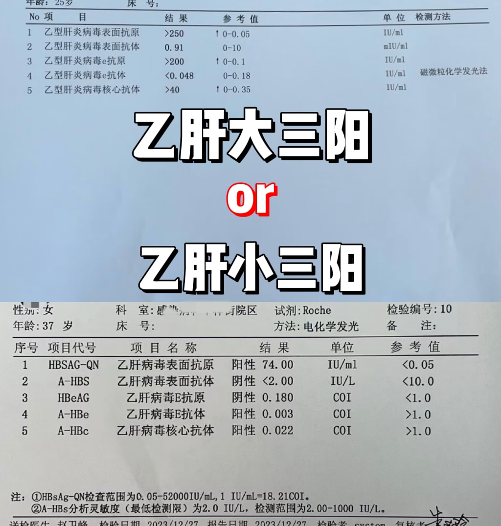 看到很多朋友们问乙肝报告怎么看的问题,作为医生的我肯定是义不容辞