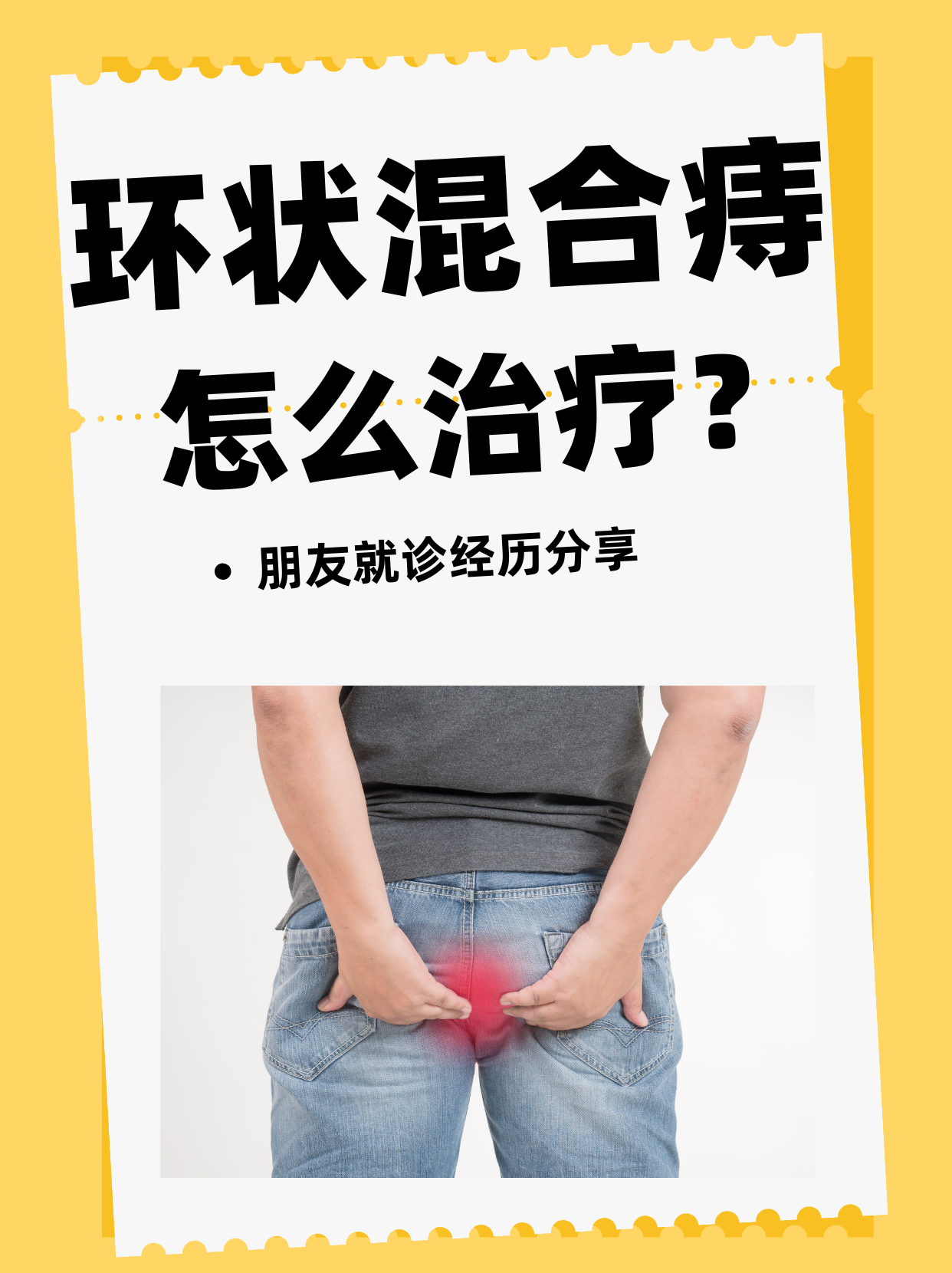 痔疮是因为什么原因得的为什么在线