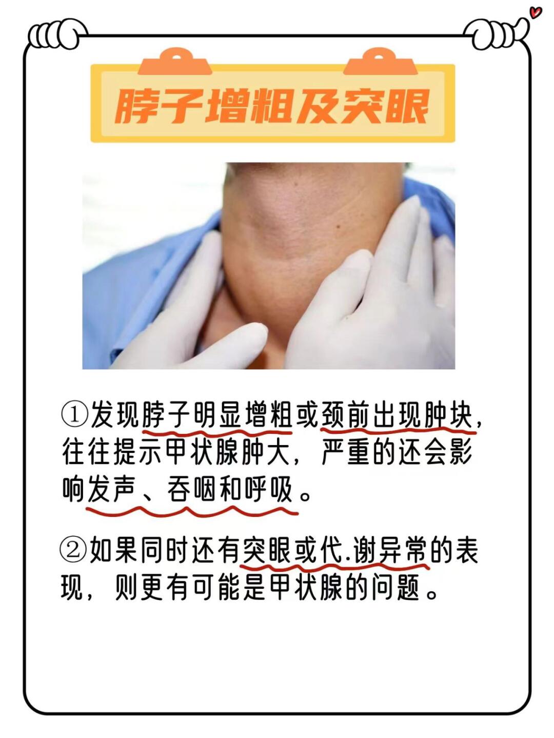 当身体出现下列异常时,可能与甲状腺功能异常有关,请务必及时进行检查