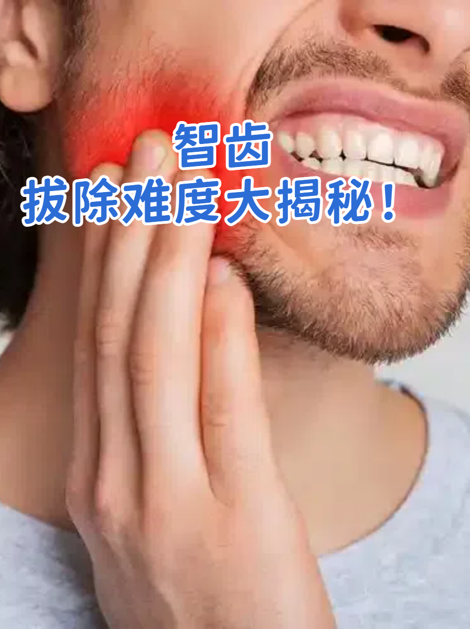 为什么拔智齿会脸肿其他牙不会为什么在线