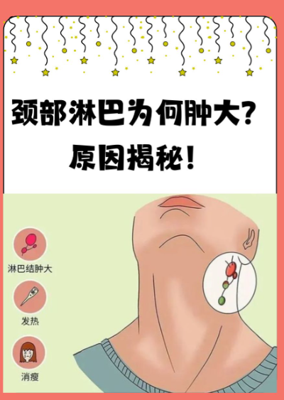 颈部淋巴结肿大能自愈吗 				 颈部淋巴结肿大能不能自愈,得看具体