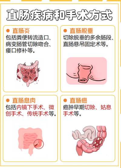 直肠癌的miles手术和dixon手术有什么区别?