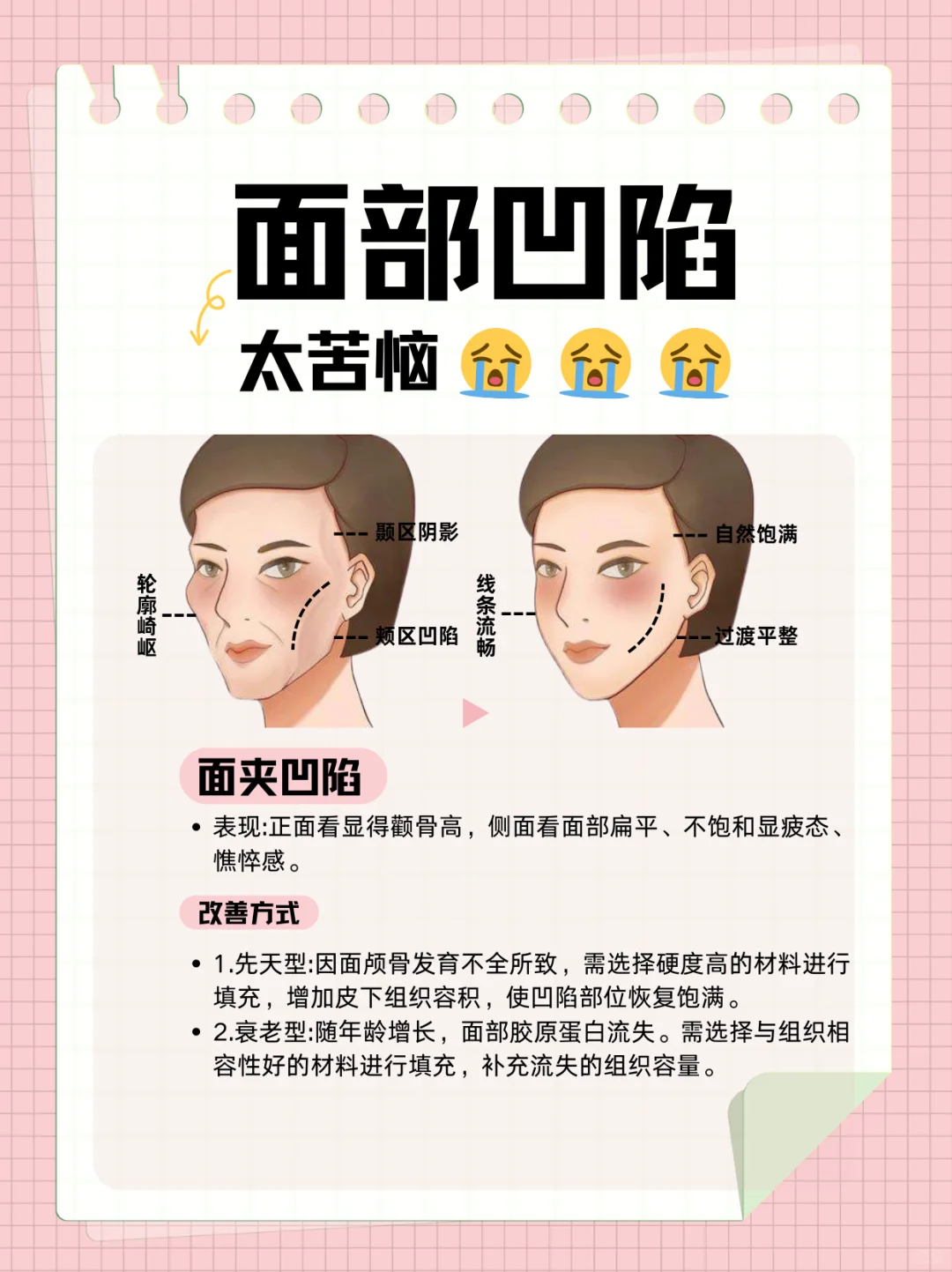 脸部凹陷会影响面部美观,别担心,有办法改善