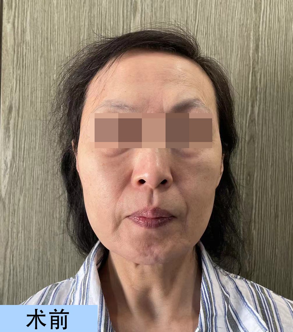 我今年59岁,在年近花甲的岁数,体会到衰老的加