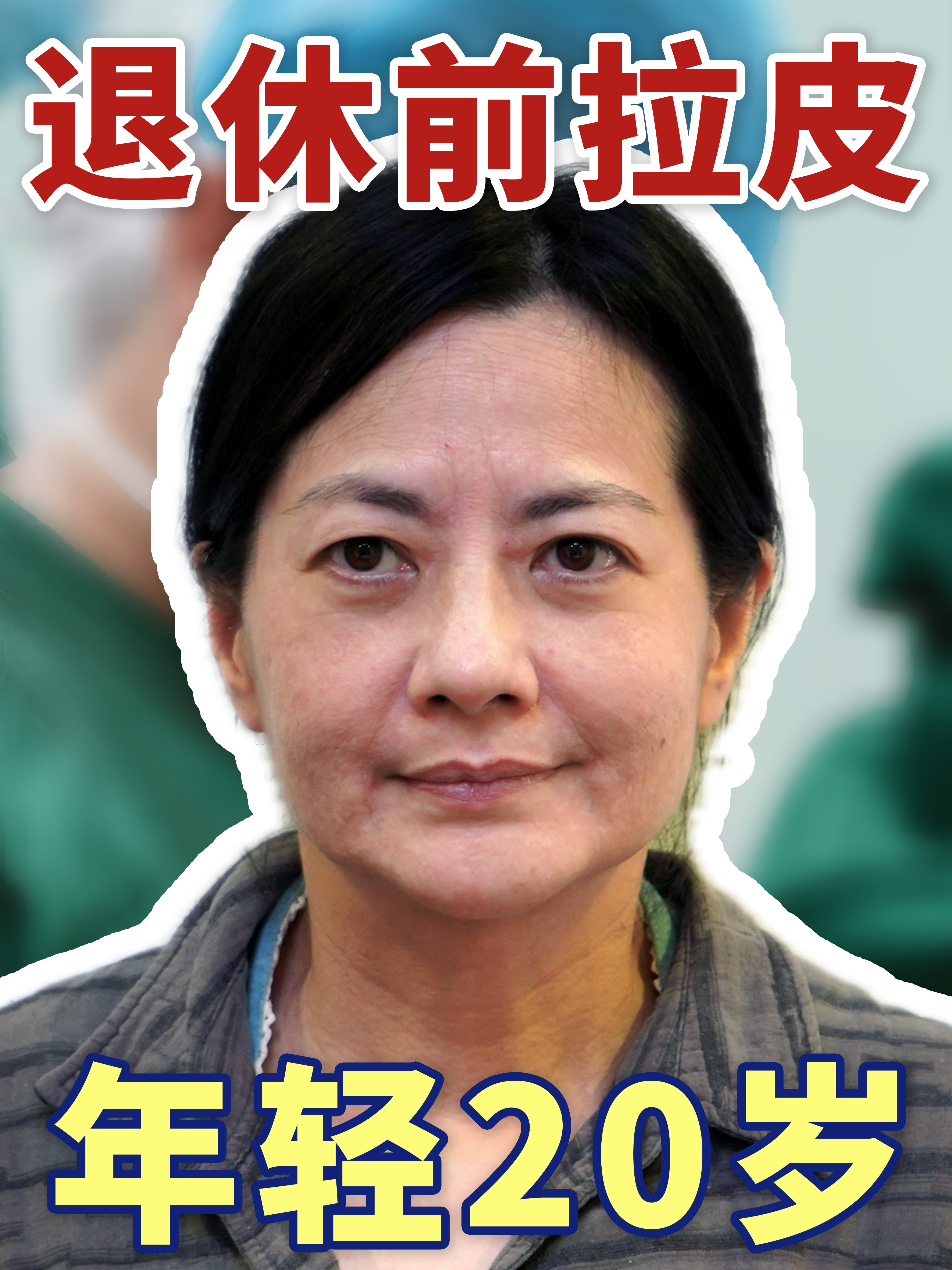 54岁姐姐退休前自费拉皮,术后表示:年轻20岁!值得做!