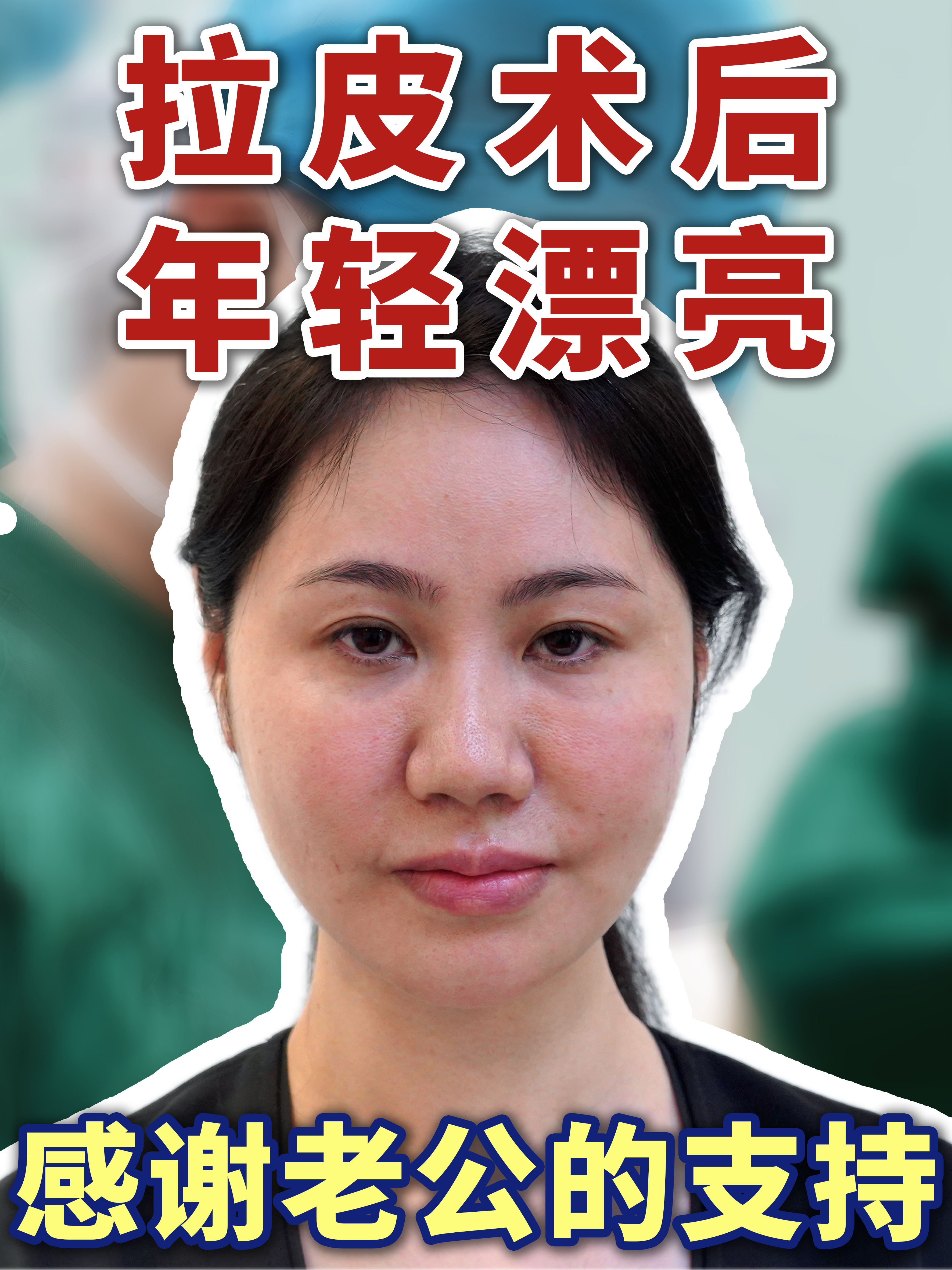 老公支持下,勇敢挑战拉皮手术,术后年轻又漂亮,感谢
