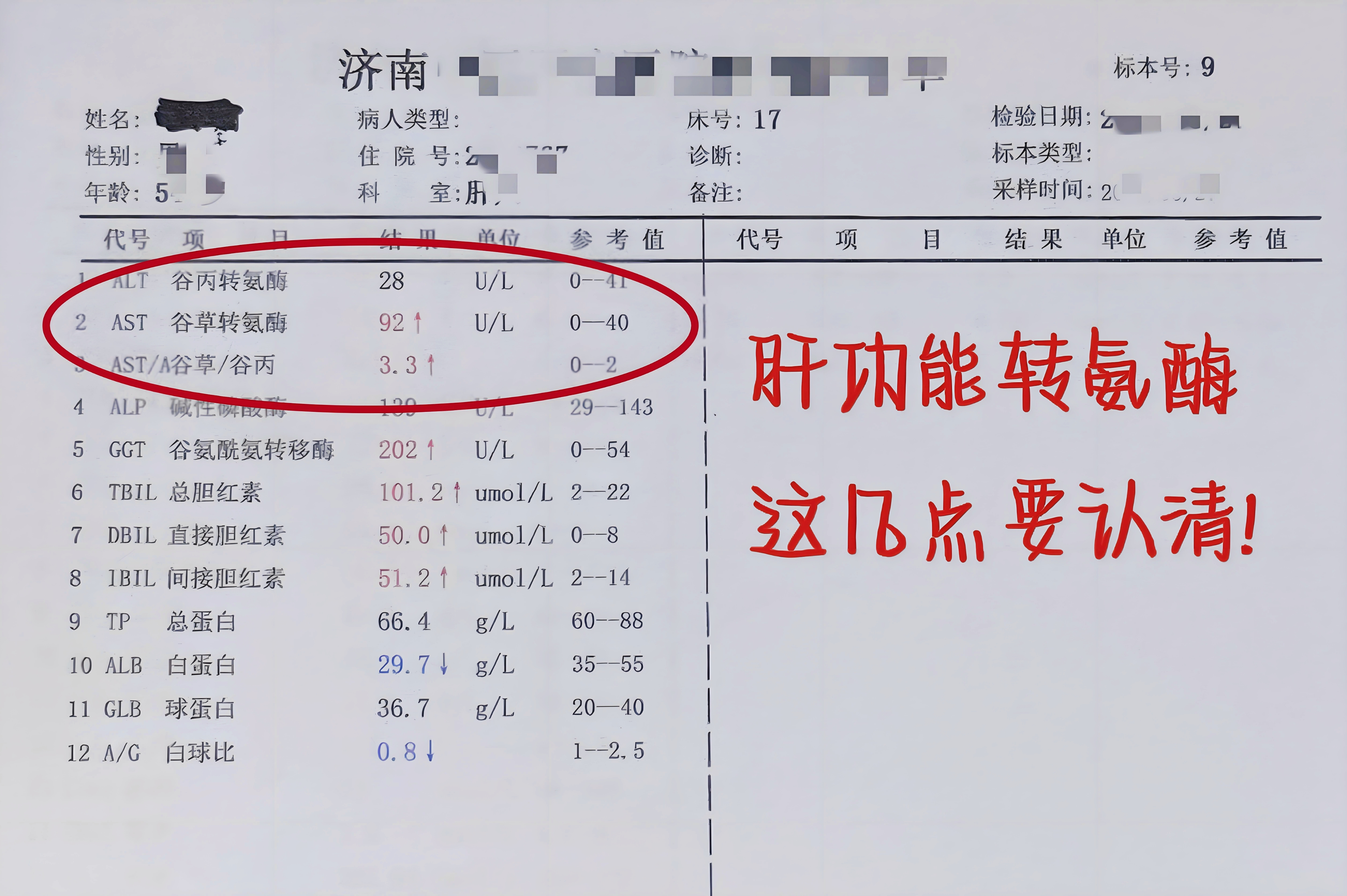 肝炎指标化验单图片