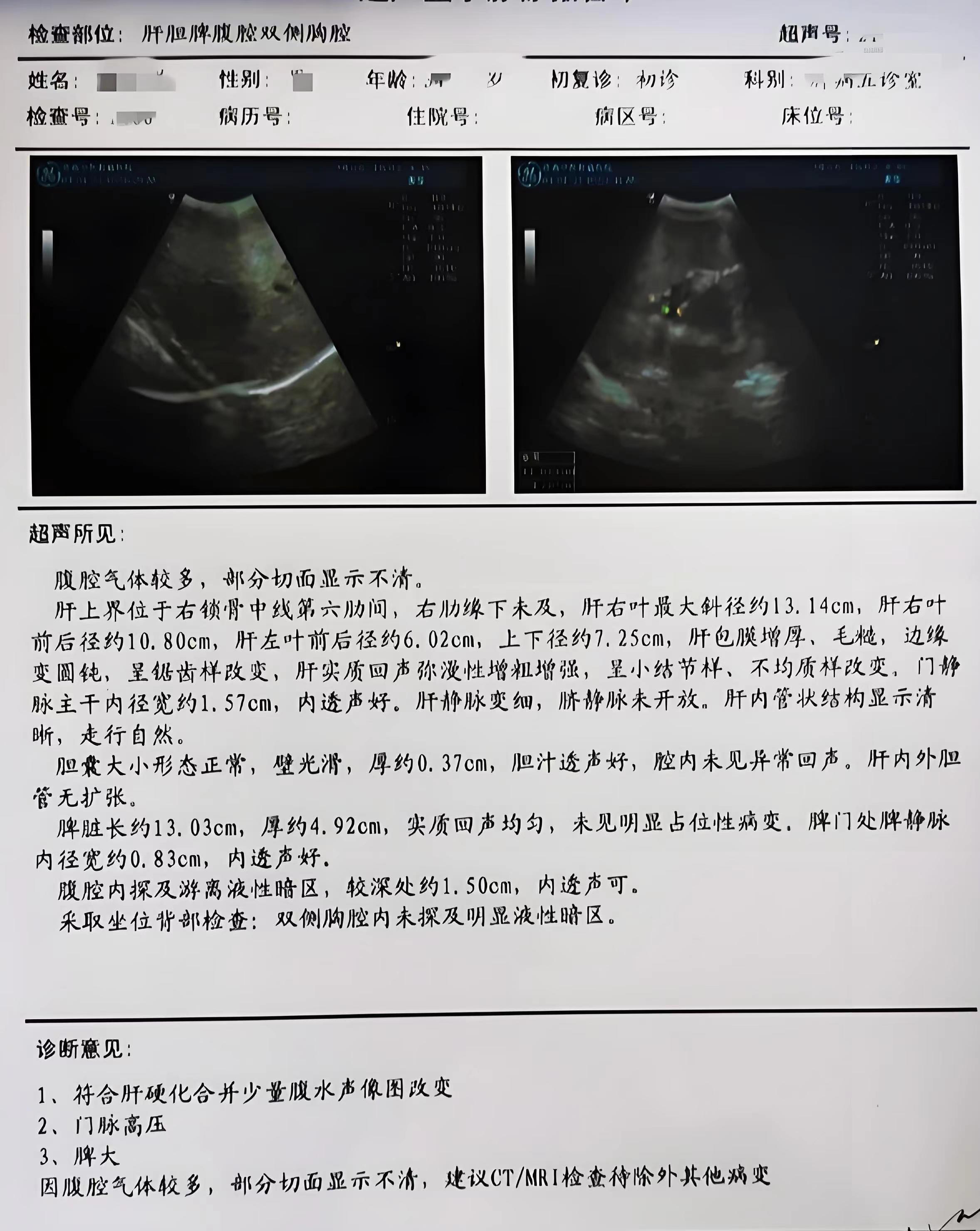 肝包膜图示图片