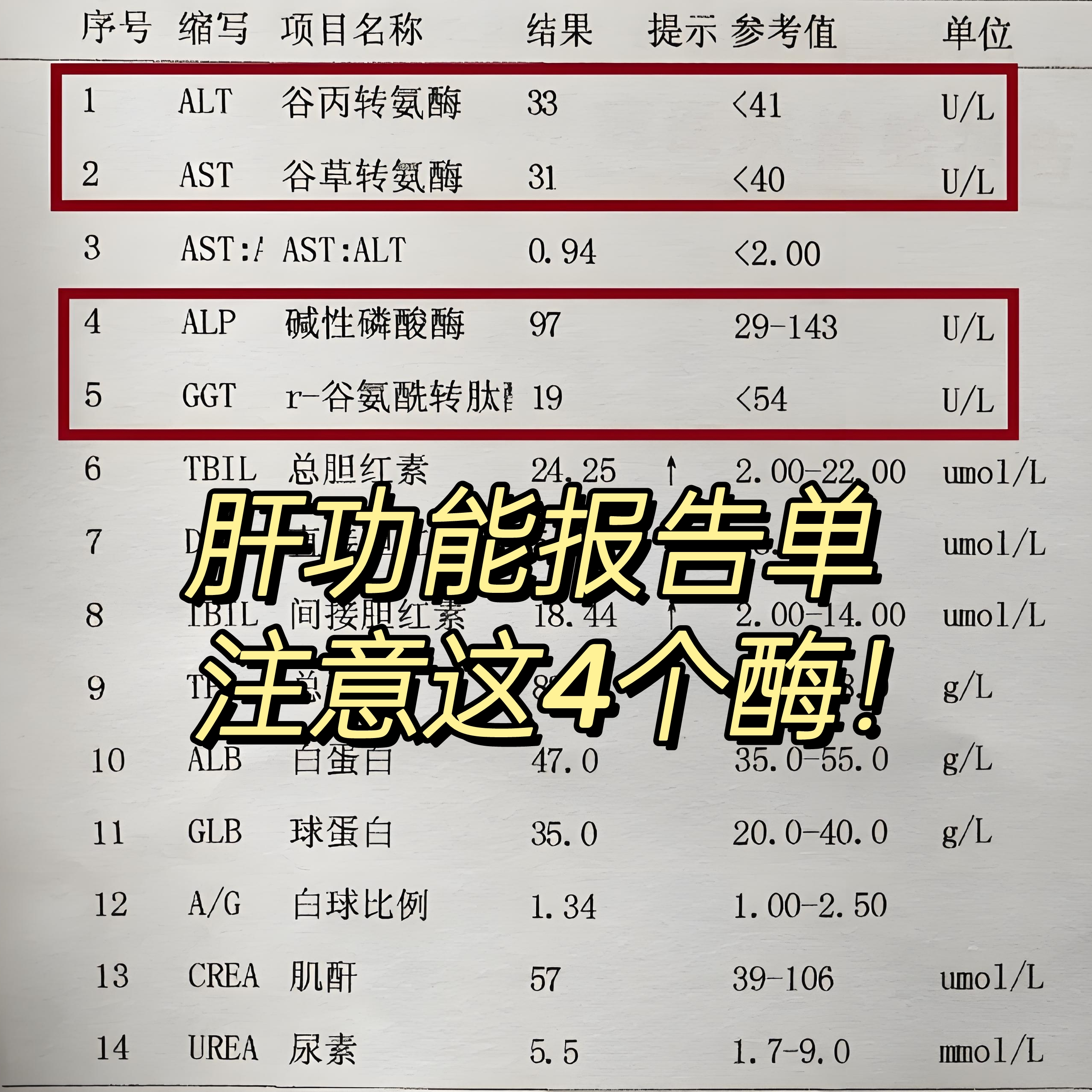 谷丙转氨酶一种存在于肝细胞浆内的转氨酶,当肝病发生时,会让细胞膜