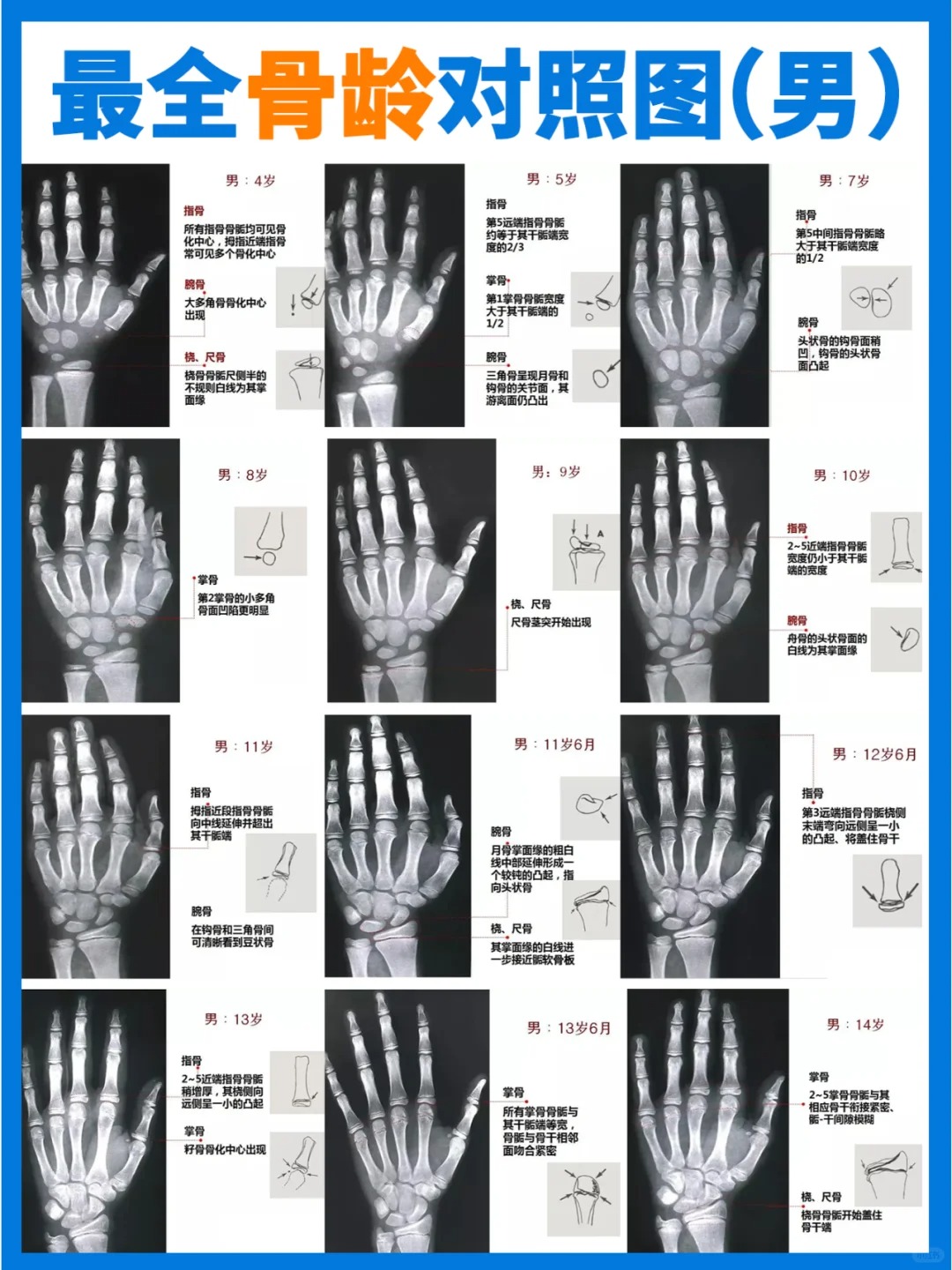 骨龄,简单来说,就是骨骼的年龄,它可是孩子生长发育的小小"晴雨表"