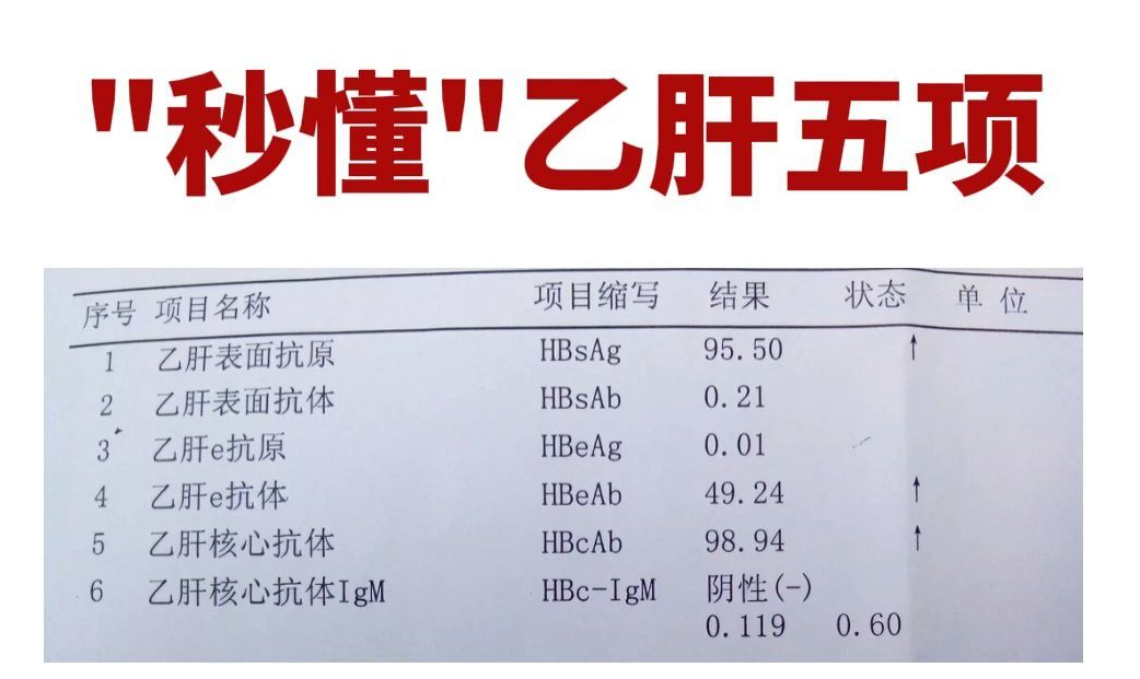 乙肝没有抗体的图片图片