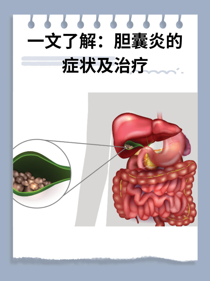 慢性胆囊炎有什么症状图片