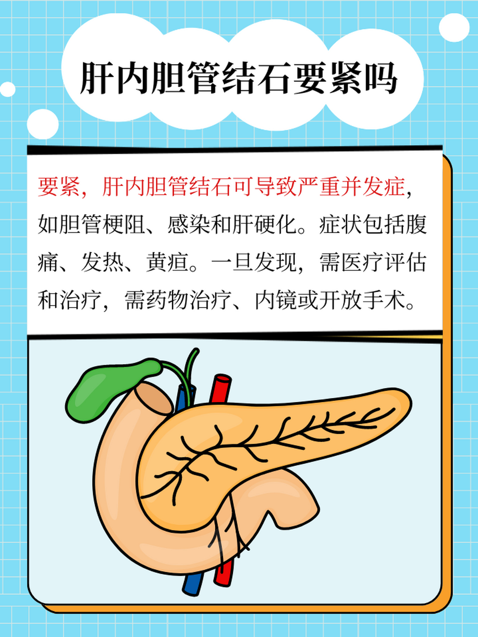 97肝内胆管结石风险:如何治疗 7815肝内胆管结石,这个听起来有