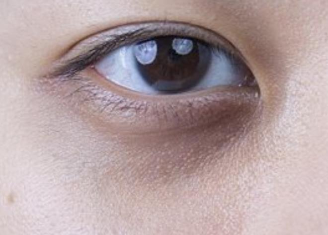 膝盖疼,腰腿疼,功能减退,听力下秸Ｑ酆诹侥亏龊诩》艏状 眼睛上白白