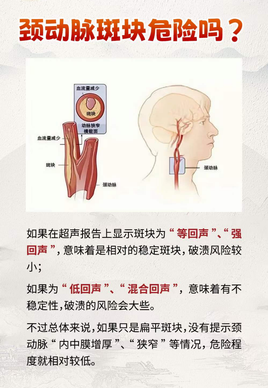 颈动脉斑块的位置图片