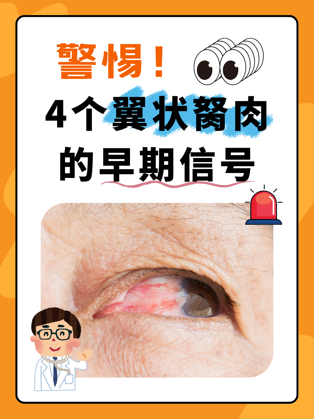 4个翼状胬肉的早期信号