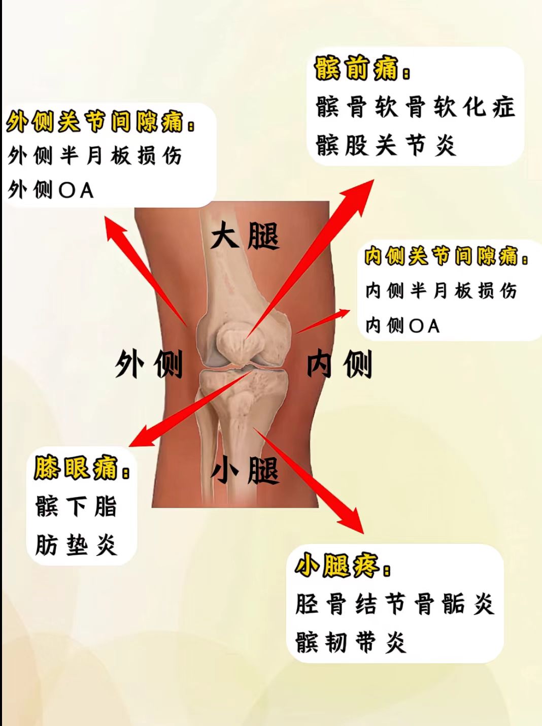 膝关节不同位置疼痛鉴别,你是哪个位置?疼多久了?