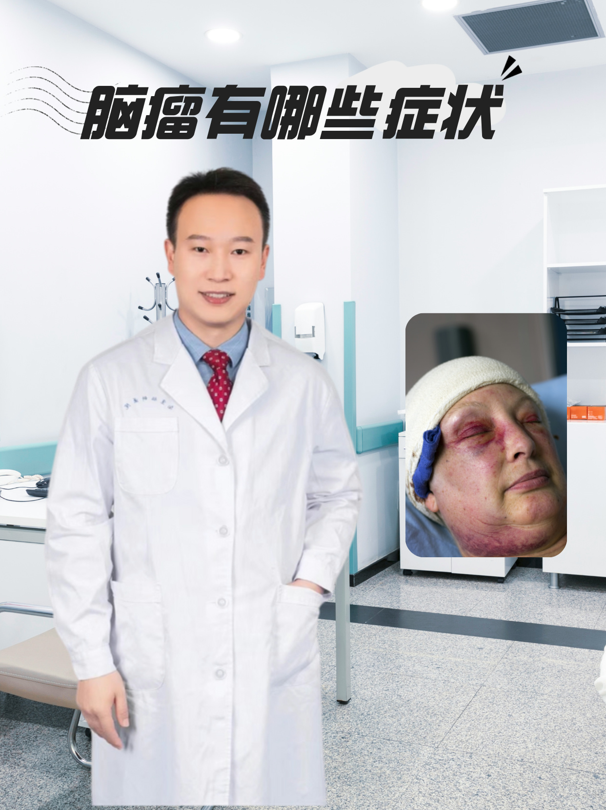 脑瘤有哪些症状 脑瘤的症状因其生长部位,大小,性质及生长速度的不同