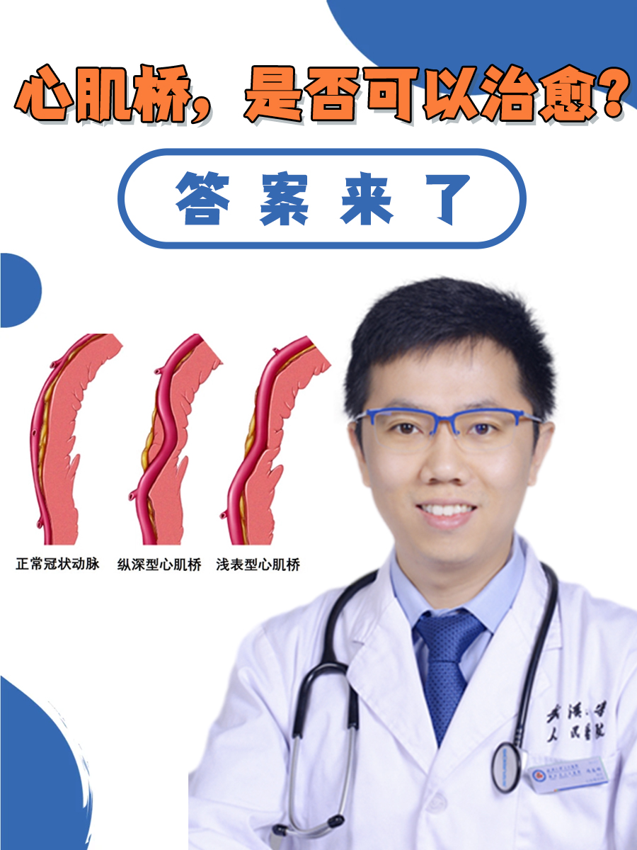 心肌桥的症状心肌桥图片心肌桥症状老年后消失冠脉肌桥心脏肌桥心肌桥