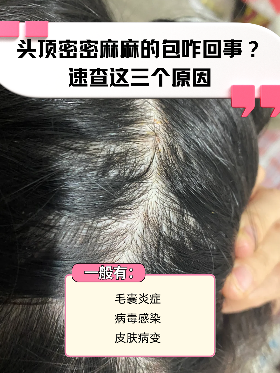 为什么头上总是长小包 为什么头上总是长小包