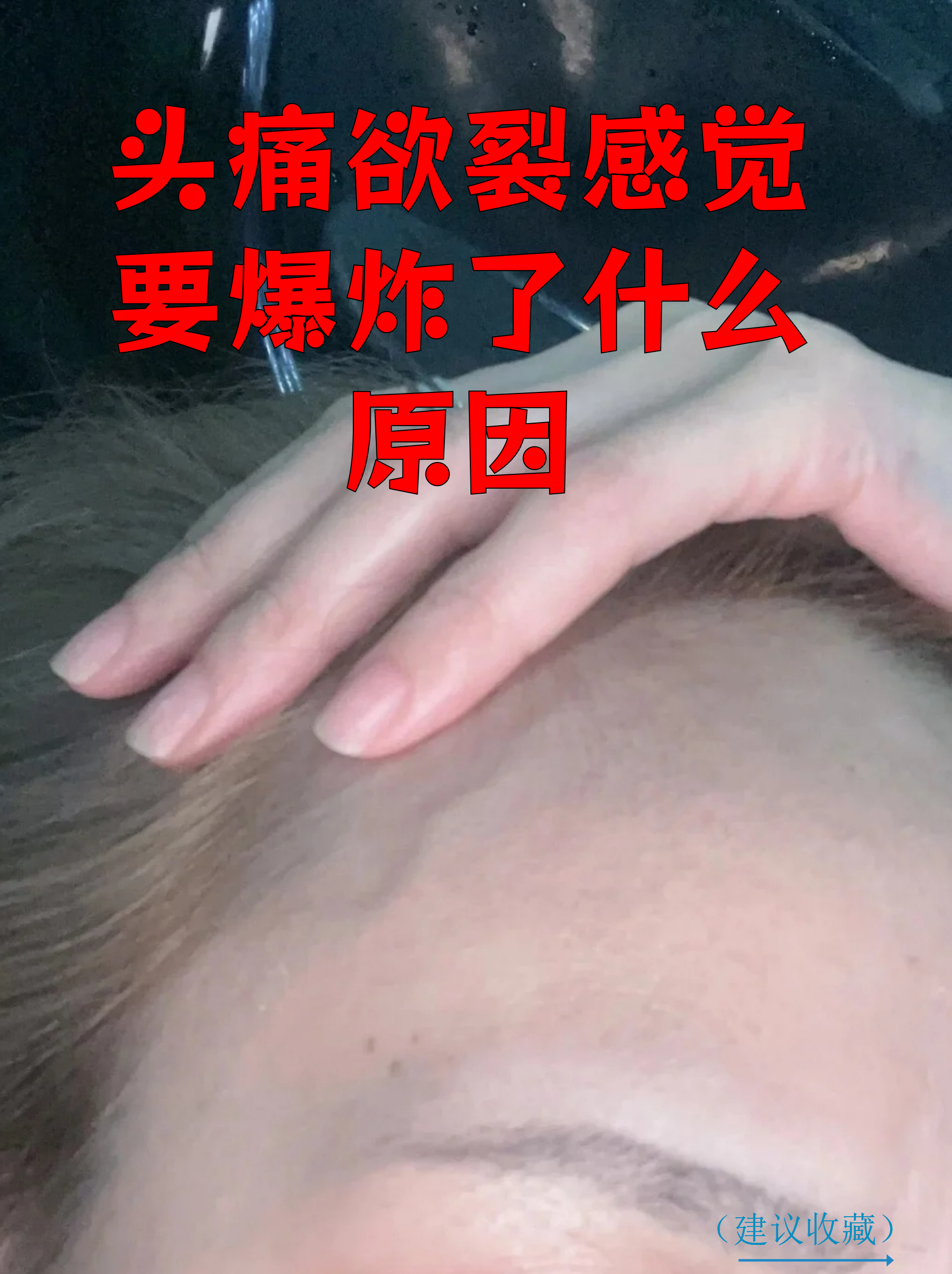 常见原因 紧张性头痛:长期