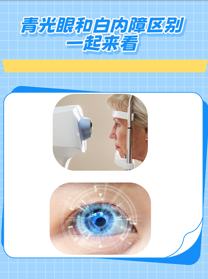 青光眼和白内障区别:一起来看  青光眼和白内障属于是眼部不同的疾病