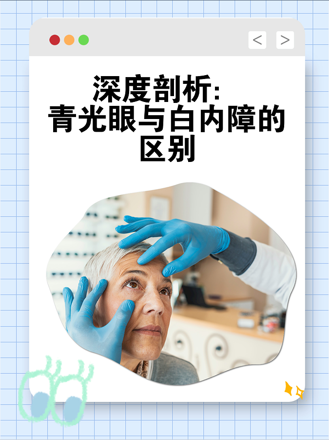深度剖析:青光眼与白内障的区别 青光眼与白内障是两种不同的眼科疾病