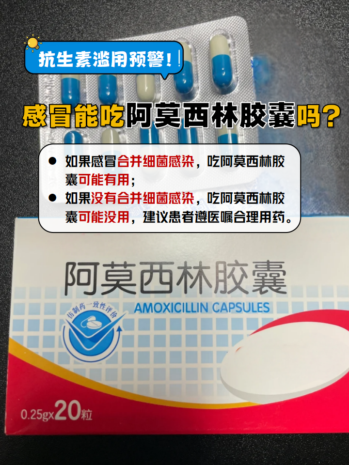  细菌性感冒吃什么药效果好(细菌性感冒吃什么药效果好细菌性咳嗽可引起哪些)