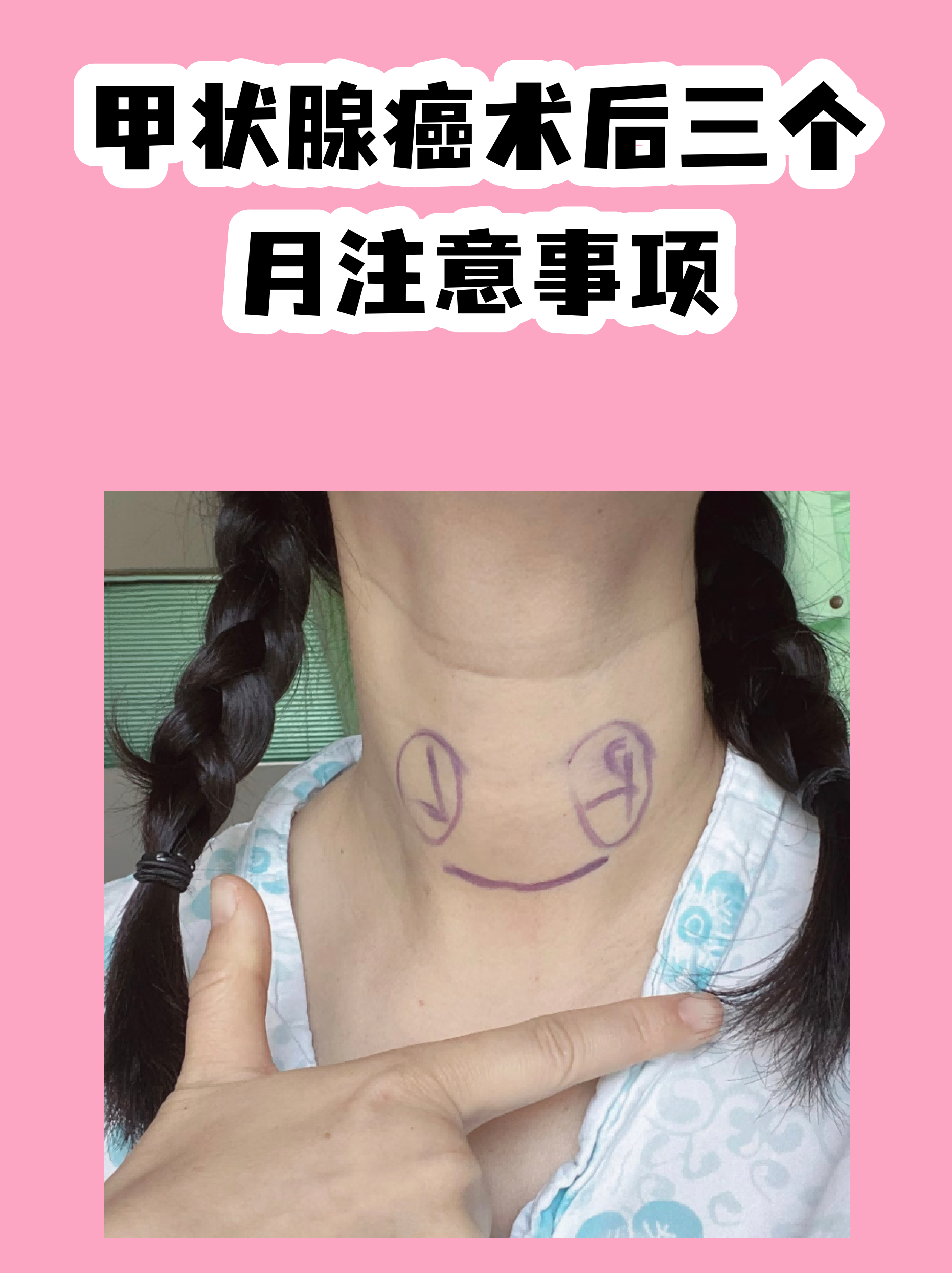 安贞医院预约挂号陪诊一体出院居家护理提醒,科学恢复身体的简单介绍 安贞医院预约挂号陪诊一体出院居家护理提醒,科学恢复身体的简单介绍