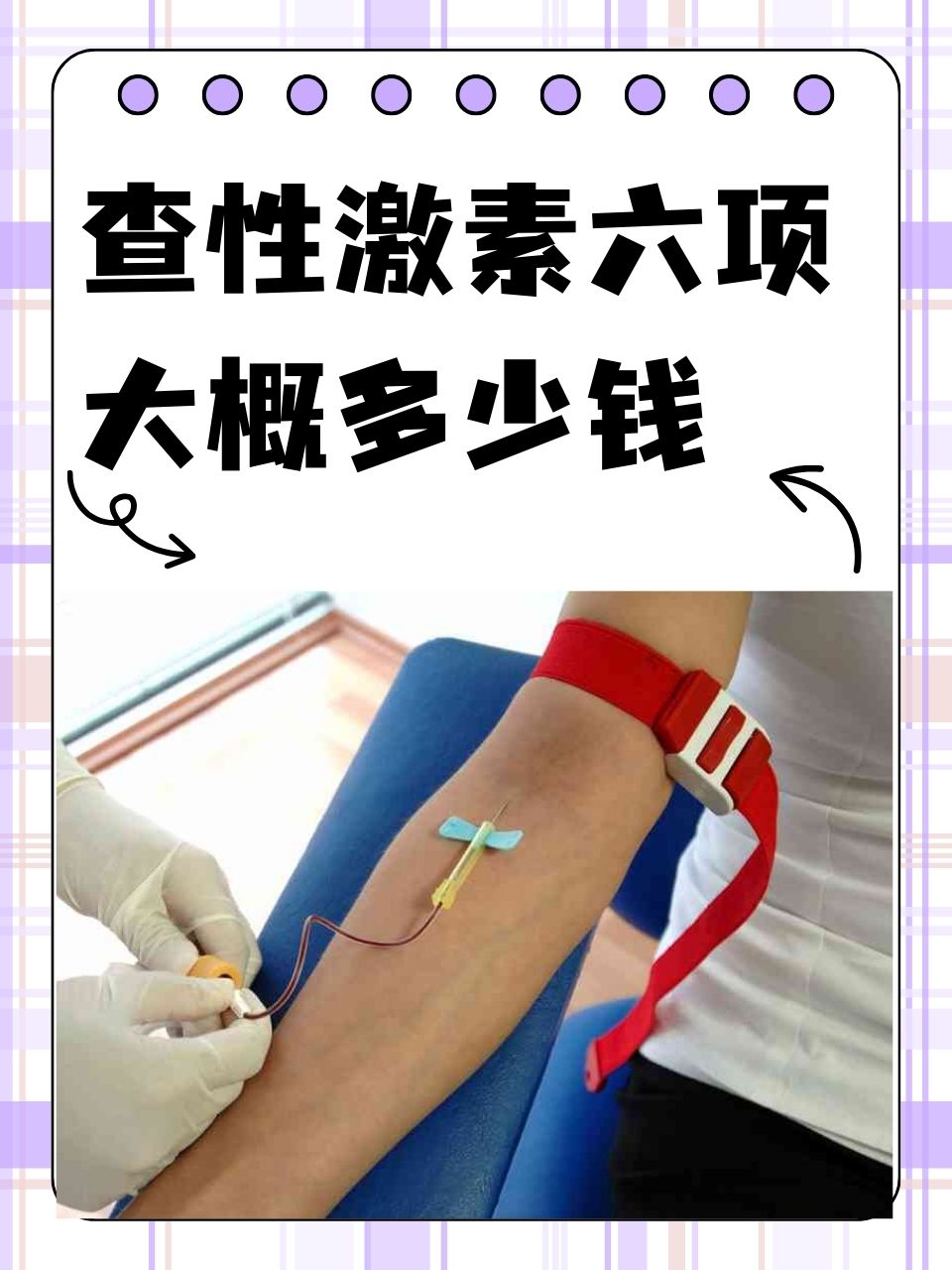 性激素六项检查需要多少钱?