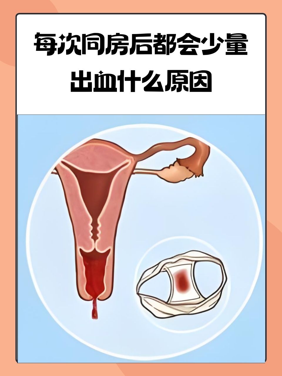 两个人同房后为什么会有血