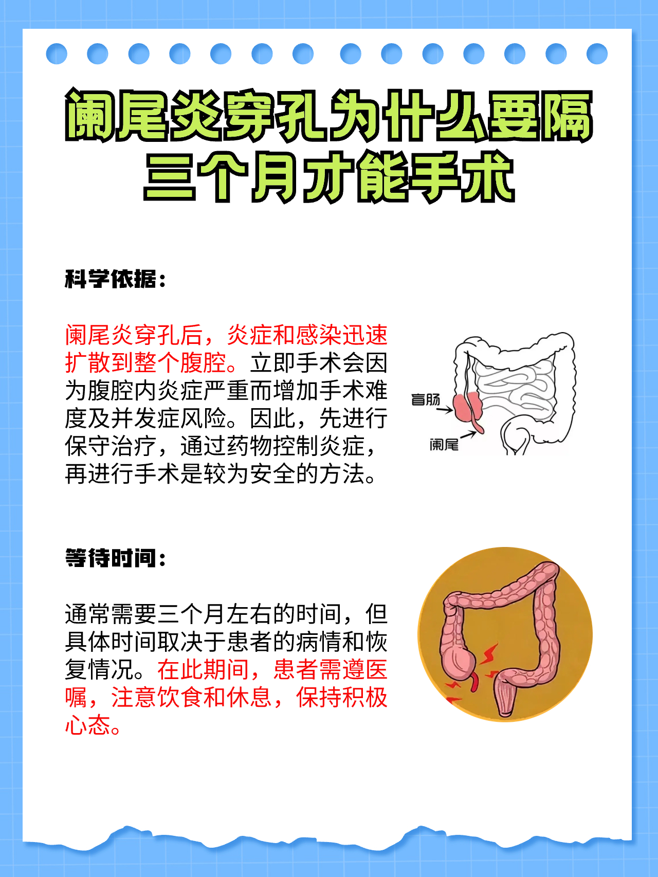 很多人可能不解为什么阑尾炎穿孔后要隔三个月才能手术呢这其中有